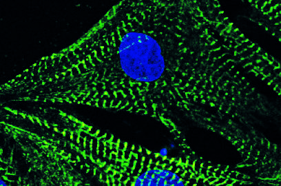 Die Abbildung zeigt Herzmuskelzellen, blau ist der Zellkern und grün das Zytoskelett. Forscher ergründen, wie Herzschwäche vermieden werden kann.