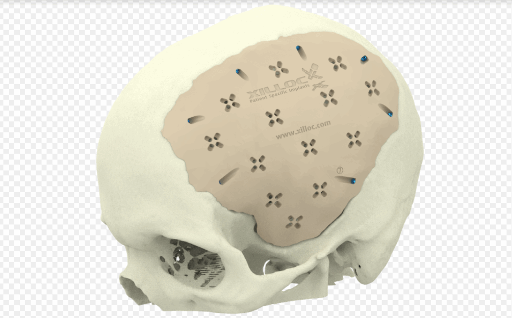 This image has an empty alt attribute; its file name is Schermafbeelding-2020-11-25-om-12.59.35-1-1004x624.png