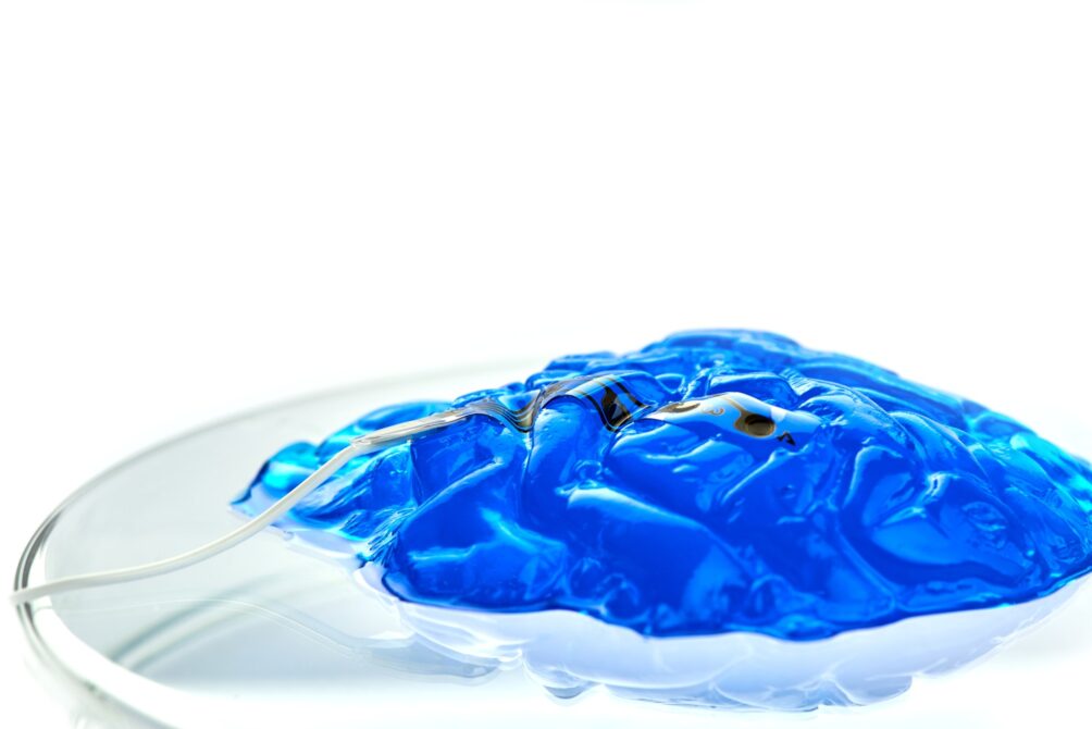 This image has an empty alt attribute; its file name is Neuro-elektroden-van-Europese-makelij-zijn-antwoord-op-Elon-Musk2-1004x670.jpg