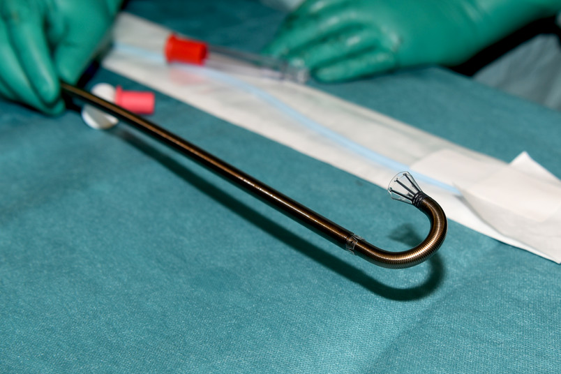 tromboseverwijdering