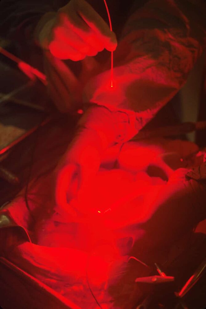 chronische Wunden, Antibiotikaresistenz, nicht-invasive Therapie, Phototherapie